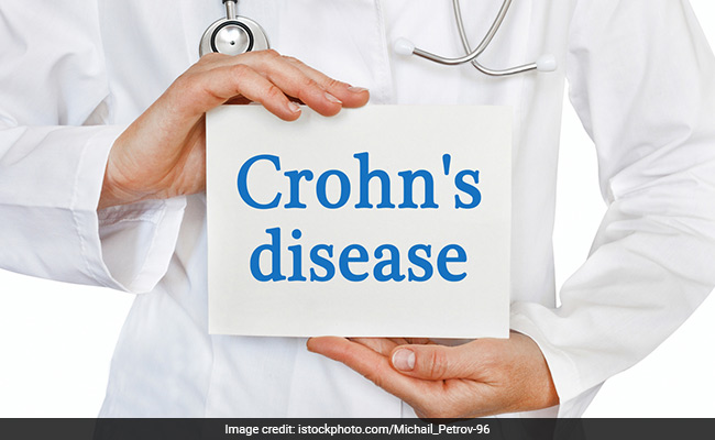 All You Need To Know About Crohn's Disease