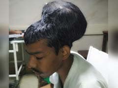 Mumbai Man's Huge Tumour "Sat Like A Head On Top Of Another Head"