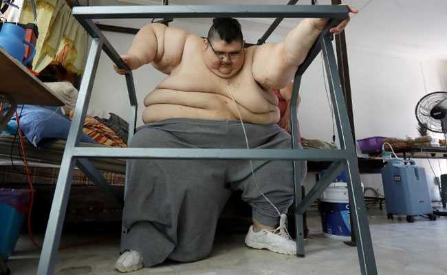 Mexican Man, Once The World's Fattest, Dreams Of Walking Again