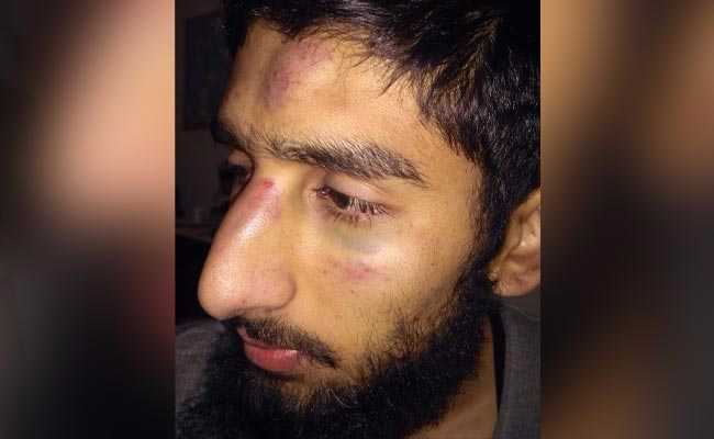 2 Kashmiri Students Assaulted By Mob In Haryana After Friday Prayers
