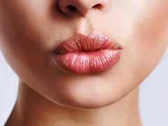 Essential Tips To Make Your Lips Soft; Bring These Superfoods To Your Rescue