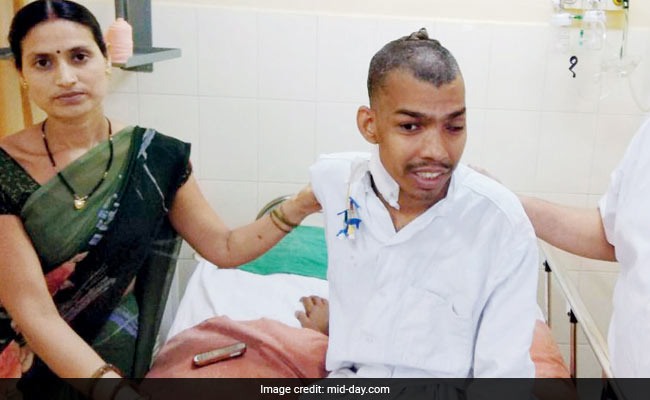 Mumbai Doctors Remove Tumour Weighing 1.8 Kg From Man's Head