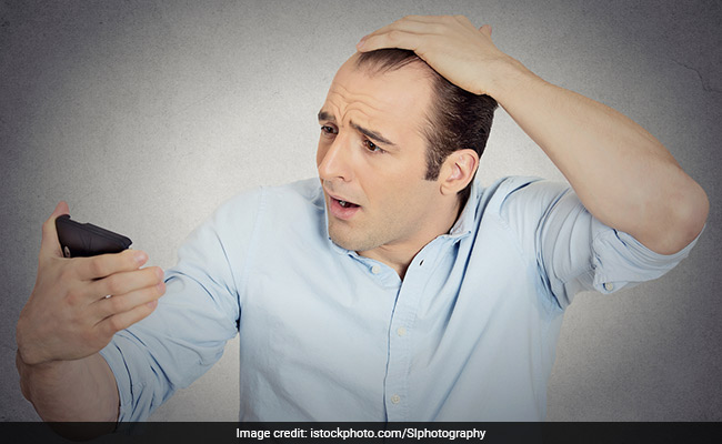 Hair loss cause : यहां जानिए किन विटामिन्स की कमी से बालों का झड़ना होता है शुरू