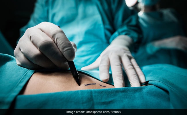 Bengal Man Arrested For Selling Wife's Kidney. She Didn't Even Know It Was Gone.