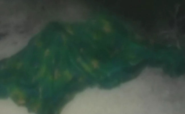 Teen Burnt To Death Outside Her Village In UP's Unnao