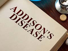 Addison's Disease: Know The Signs And Symptoms Of This Condition