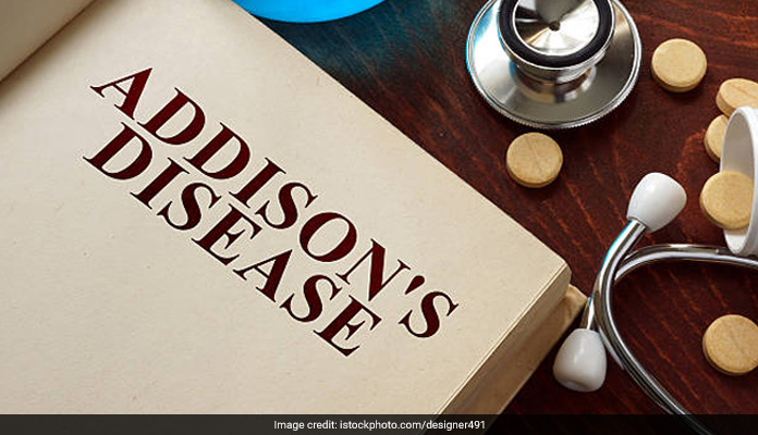 Addison's Disease: Know The Signs And Symptoms Of This Condition