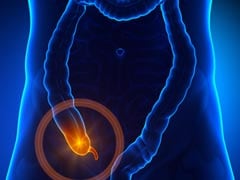 How To Prevent And Treat Appendicitis Naturally