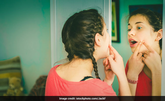 Now Get Rid Of Your Blackheads With These Amazing Natural Ways