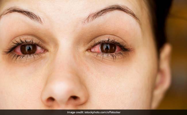 conjunctivitis cold or warm compress