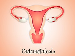 Getting Pregnant With Endometriosis: Is It Possible?