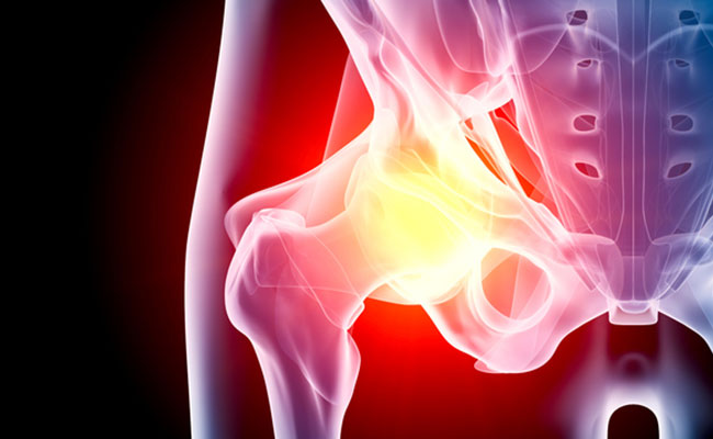 What Are The Causes Of Groin Pain And Home Remedies To Deal With It