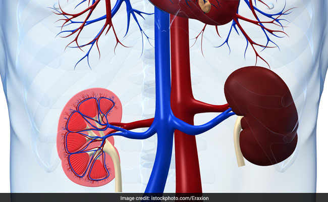 गुर्दा खराब होने पर मरीजों को डायलिसिस से छुटकारा दिलाएगा आयुर्वेद, ये दवा कर सकती है मदद