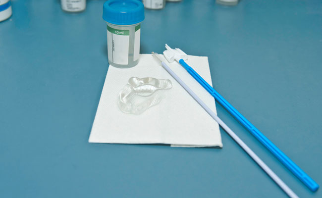 Why A Pap Smear Is Important? Health Conditions That It Detects
