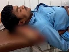 Doctors Suspended After Severed Leg Used As Pillow In UP's Jhansi