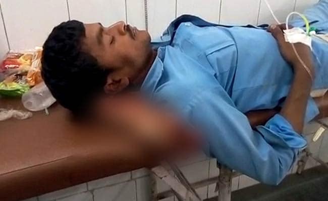 Doctors Suspended After Severed Leg Used As Pillow In UP's Jhansi