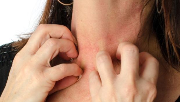 9 Signs You Need To Visit A Dermatologist