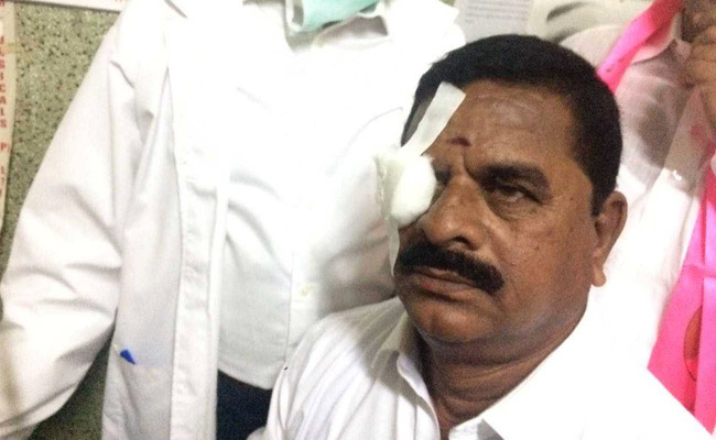 Congress Lawmaker Threw Headphone In Telangana Assembly. It Hit Council Head's Eye