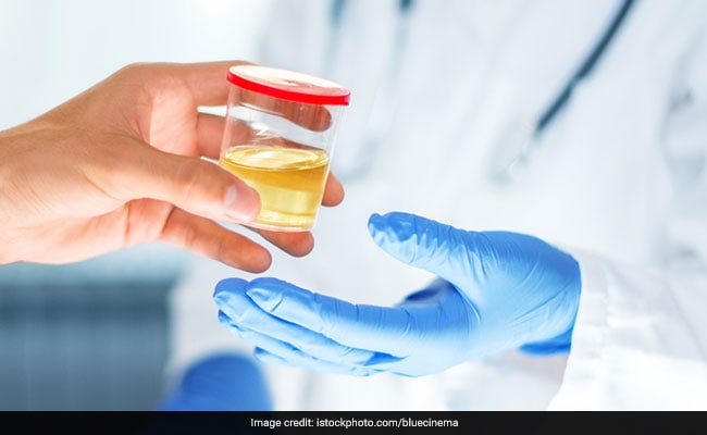 Latest and Breaking News on NDTV Latest and Breaking News on NDTV