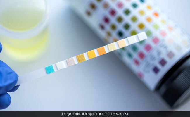 Simple Urine Test May Predict Biological Age, Death