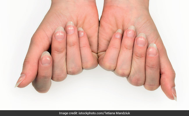 What Are The White Spots On Your Nails Trying To Tell You?