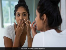Poor Dietary Habits, Increased Stress And Harsh Skincare Routines Linked With Acne, Says Study Poor Dietary Habits, Increased Stress And Harsh Skincare Routines Linked With Acne, Says Study