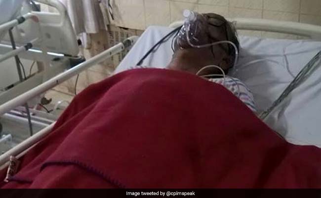 Ahead Of Panchayat Polls, Veteran CPI(M) Leader Attacked In Bengal