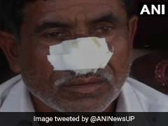 UP Man Bites Off Brother's Nose, Attacks Father After Denied Money For Alcohol