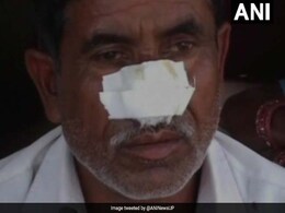 UP Man Bites Off Brother's Nose, Attacks Father After Denied Money For Alcohol UP Man Bites Off Brother's Nose, Attacks Father After Denied Money For Alcohol