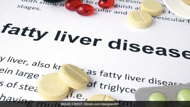 Scientists At IIT Mandi Test Effectiveness Of Zinc Oxide Supplements In Preventing Fatty Liver Disease