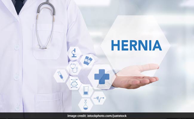 Novel App May Predict Hernia Risk After Abdominal Surgery