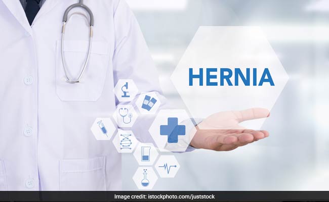 Hernia