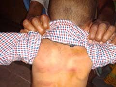 4-Year-Old In Hyderabad Couldn't Pay School Fee. Teacher Thrashed Him