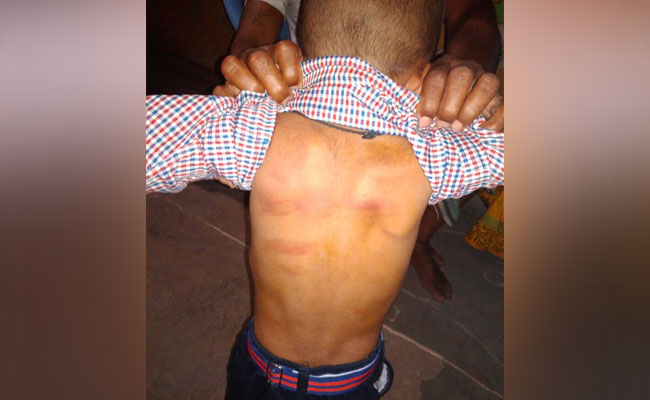 4-Year-Old In Hyderabad Couldn't Pay School Fee. Teacher Thrashed Him 4-Year-Old In Hyderabad Couldn't Pay School Fee. Teacher Thrashed Him