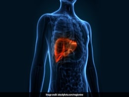 Cells From Man's Pancreas Implanted In His Liver Cells From Man's Pancreas Implanted In His Liver