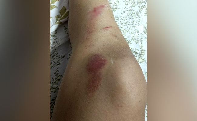 Model Says Skirt Pulled On Indore Road By 2 Who Asked "What's Underneath"