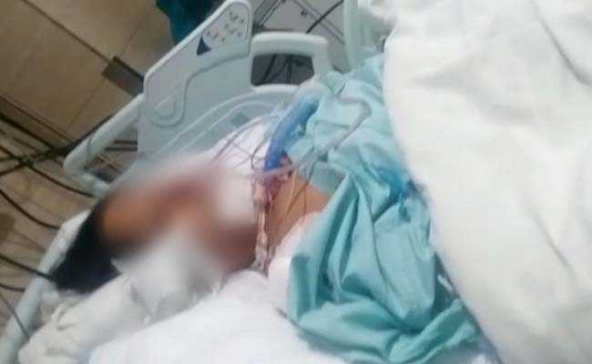 Delhi Woman Asked Friend To Return Money. She Was Stabbed 12 Times