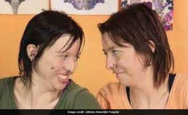 33-Year-Old Twins With Obsessive Compulsive Disorder Die In Possible 'Suicide Pact'