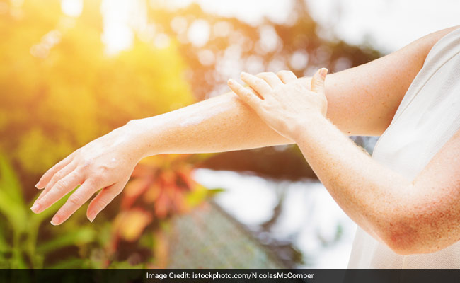 How To Treat Prickly Heat At Home