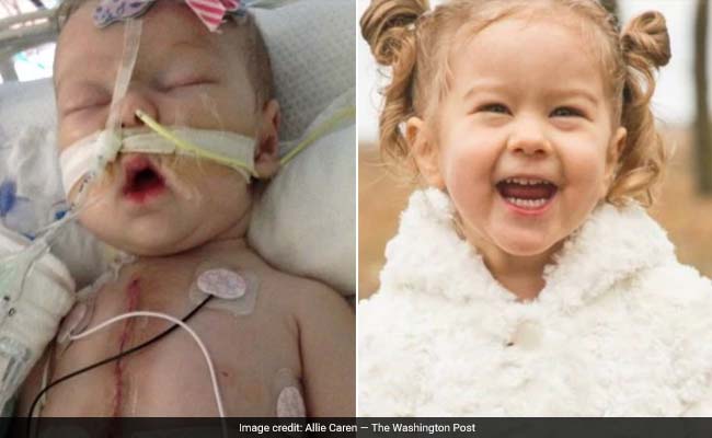 3-Year-Old Has World's Smallest Mechanical Heart Valve