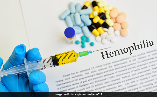 80 Per Cent Hemophilia Cases Undiagnosed In India: Doctors