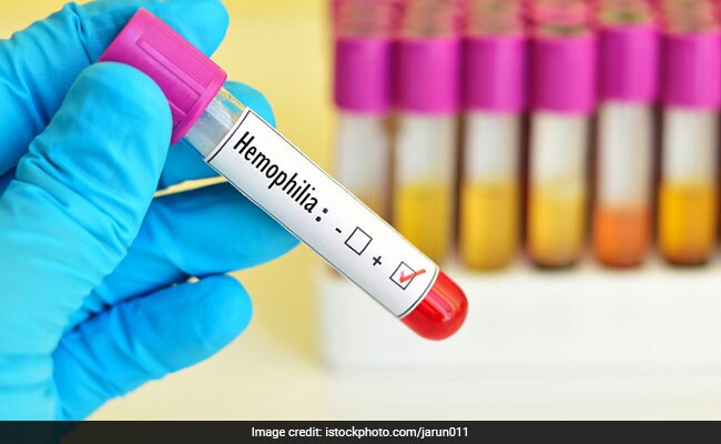 World Hemophilia Day 2020: Causes And Symptoms Of The Disease In Which