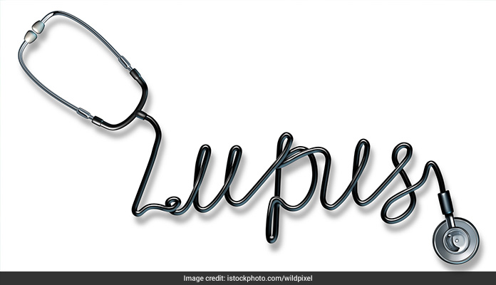 Lupus Strongly Linked To Poor Gut Health, Finds Study