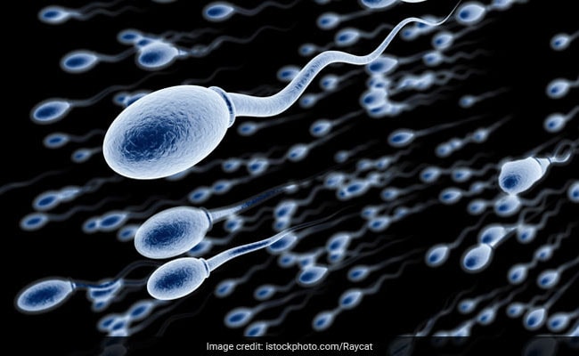 sperm