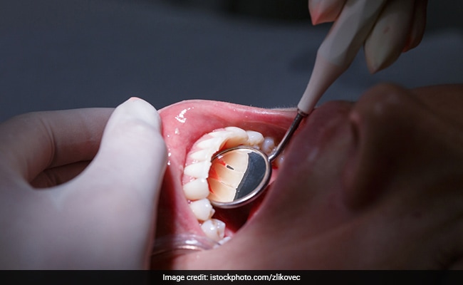 दांतों में दर्द और सड़न आपके शरीर के इस हिस्से को भी कर रहे हैं बीमार