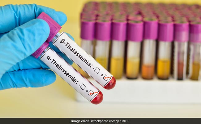 World Thalassemia Day 2023: Understanding The Different Types Of Thalassemia