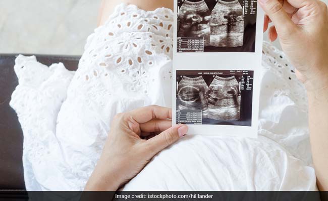 Everything You Should Know About Getting An Ultrasound While Pregnant
