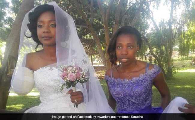 Bride-To-Be Lost Arm In A Crocodile Attack. 5 Days Later, She Got Married