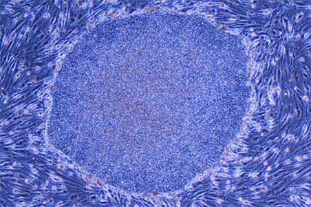 Skin cells form quick defence in body