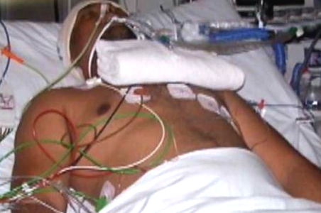 5 Aussie teens held for attack on Indians